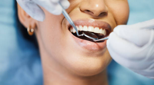 Best Emergency Treatment for Dental Infections or Abscesses in Pendleton, SC